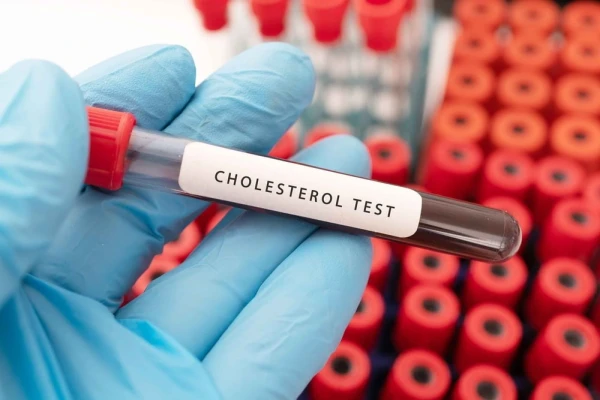 Pēc ģenētiskās diagnostikas pilotprojekta noslēguma Stradiņa slimnīca aicina turpināt testēšanu pacientiem ar augstu holesterīnu