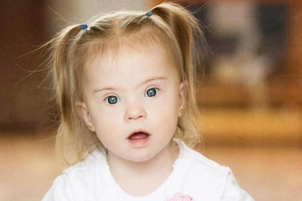 Biedrība: Sabiedrībā aizvien ir daudz mītu par cilvēkiem ar Dauna sindromu