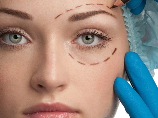 Blefaroplastika: mīti un patiesība