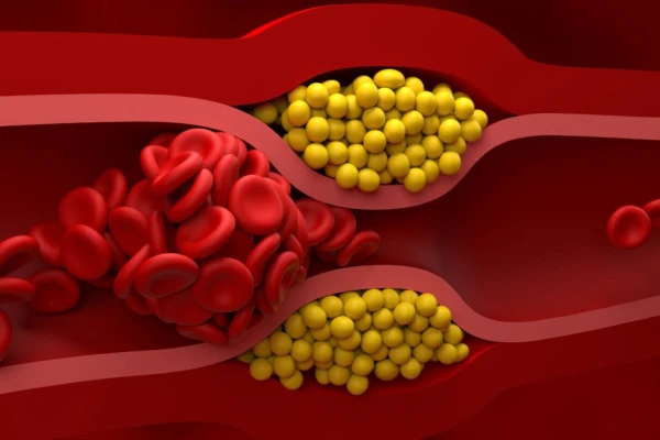 5 mīti par holesterīnu un kāpēc tos jāzina katram