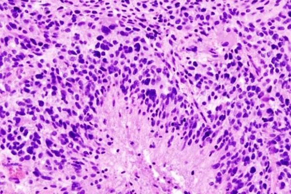 Фото: KGH / Wikimedia