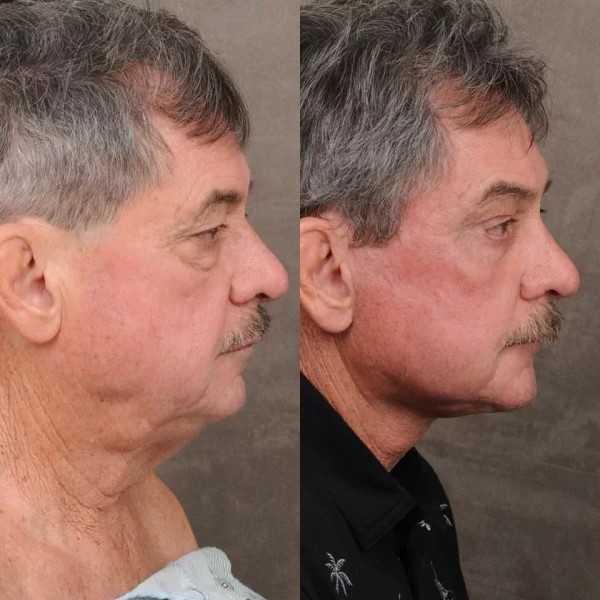 Осталось только седину извести, и как новенький.