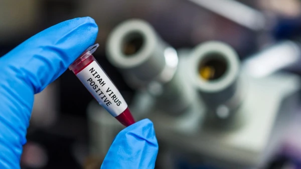 Testi lidostās un karantīnas pasākumi: kāpēc Nipahas vīruss izraisa bažas