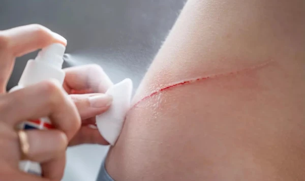 Революционное средство от царапин.