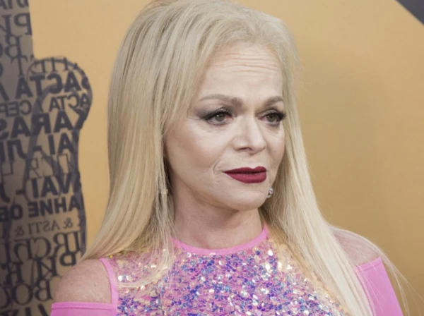 «Cik var izsmiet?» Larisas Dolinas direktors aicina pārtraukt dziedātājas vajāšanu