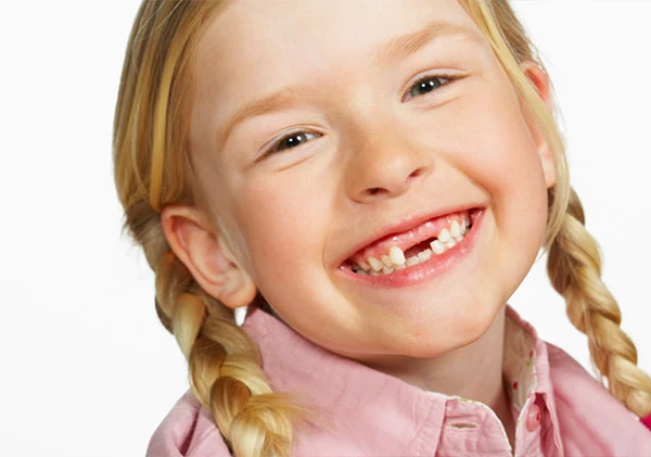 Vai nepieciešams ārstēt piena zobus vai var gaidīt, līdz tie izkritīs
