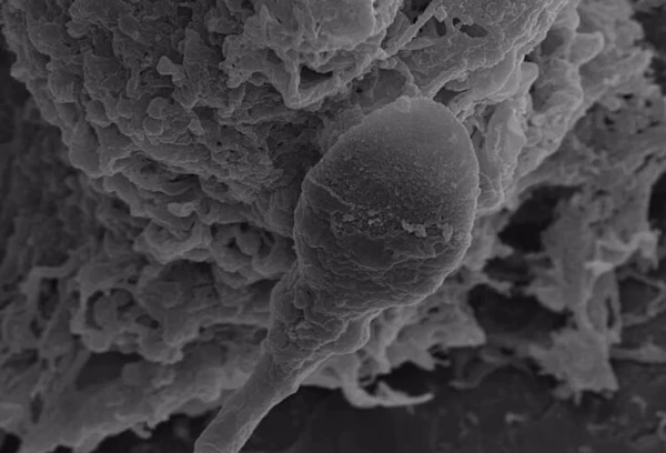 Исследователи обнаружили, что отсутствие гравитации негативно влияет на способность сперматозоидов ориентироваться в пространстве.